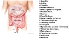 Enfermedades que afectan el sistema digestivo